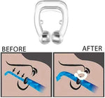 YUNGLR healthy Store Neusklem Stopper Snurken Remedie Producten Stop Clips Dilatador Neus Neus Ronflement Ronquidos Snurk Snurken -
