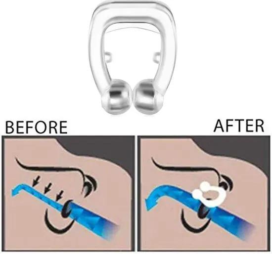 YUNGLR healthy Store Neusklem Stopper Snurken Remedie Producten Stop Clips Dilatador Neus Neus Ronflement Ronquidos Snurk Snurken -