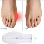 Siliconen Teencorrector & Bunion Beschermer - Hallux Valgus - 2 Stuks by BORVAT