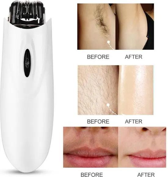 Merklose- UP / Gezichtsepilator / Bikini Epilator / Snor Epilator / Ontharing / Armen en Benen Ontharen / Snoerloos / Wit -
